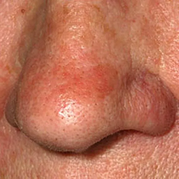 atlas image