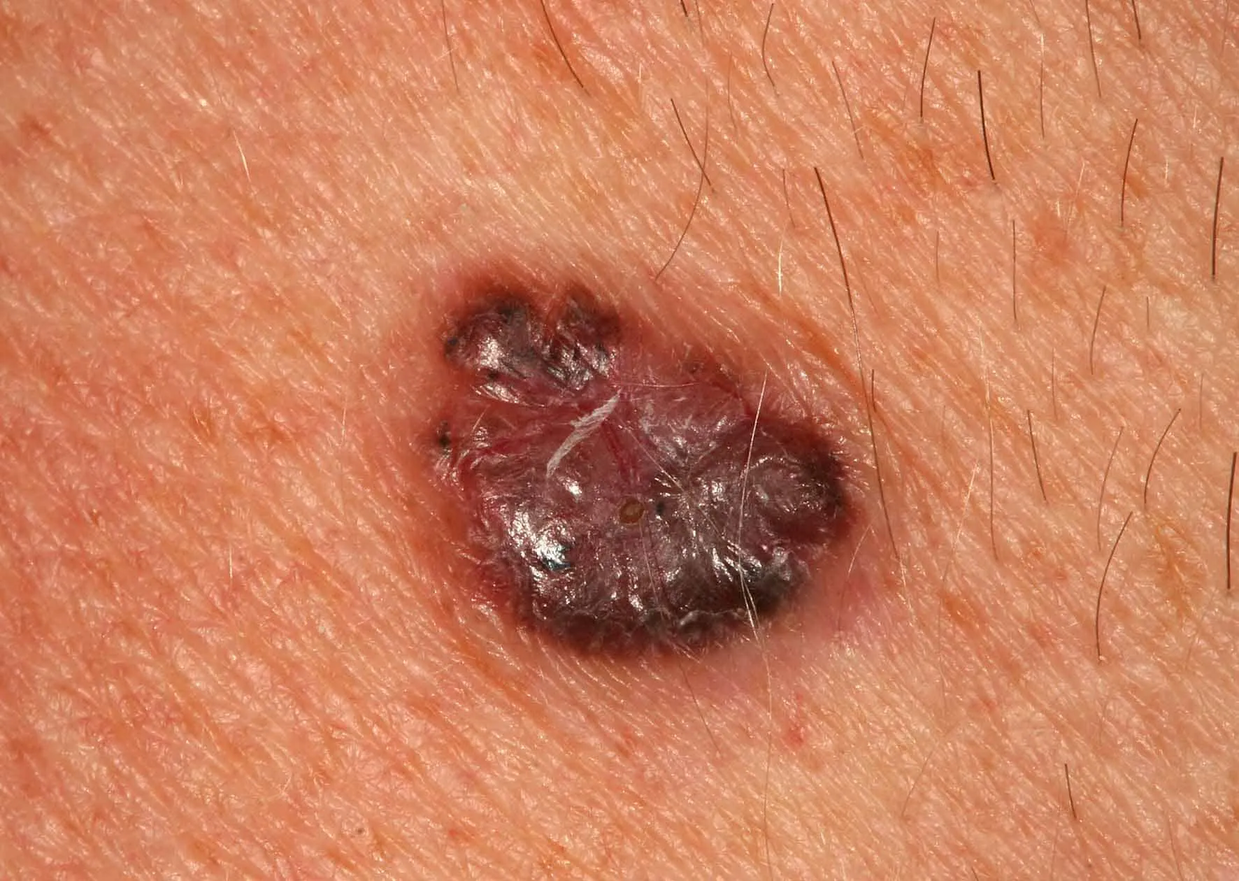 atlas image
