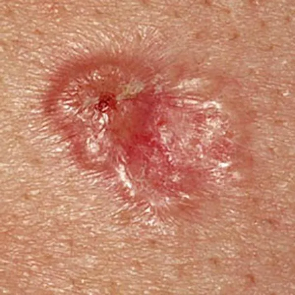 atlas image