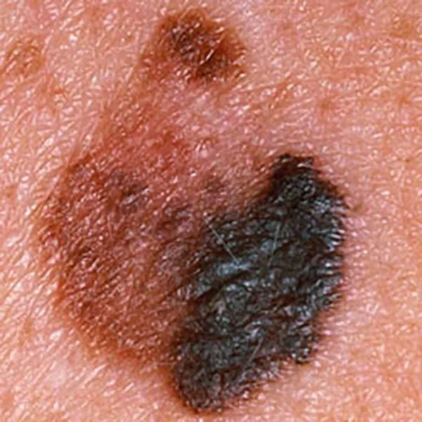 atlas image