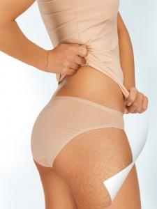 mesotherapy-225x3001 image mesotherapy-225x3001 Безболезненная мезотерапия | MedFin